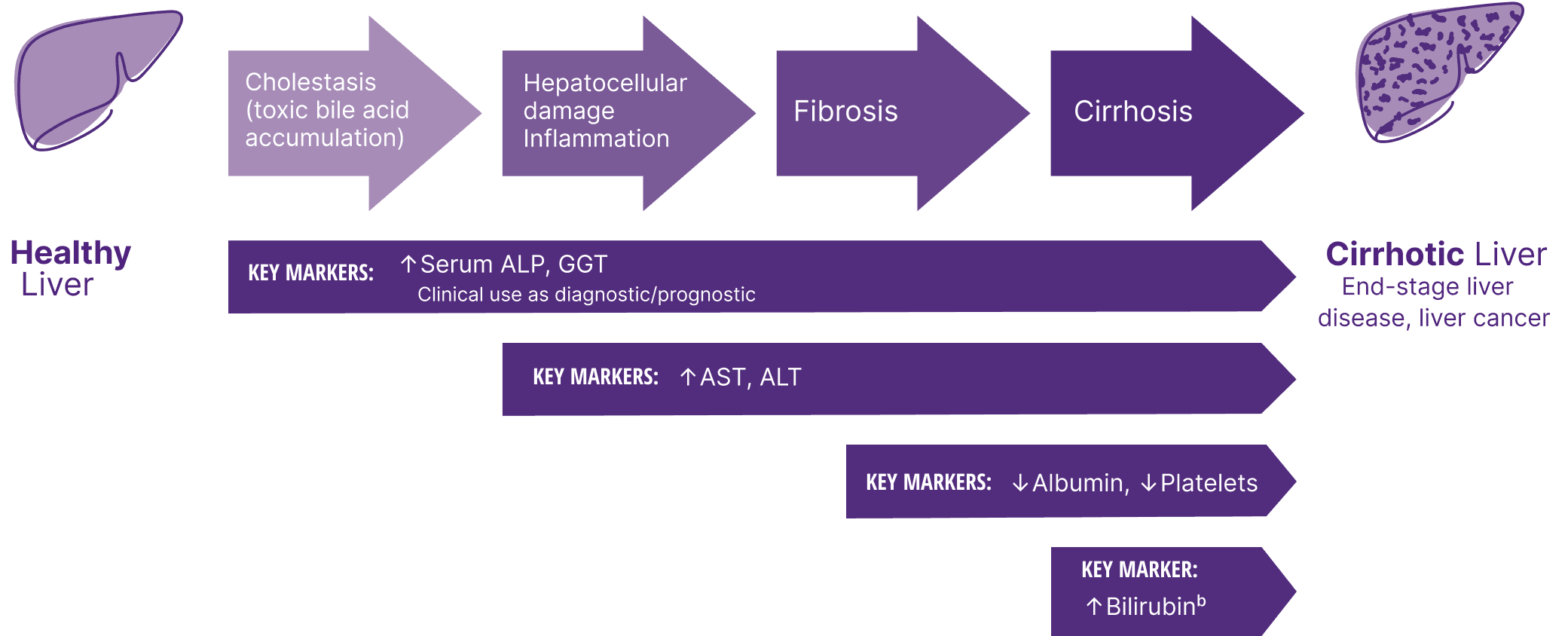 The path of PBC disease progression